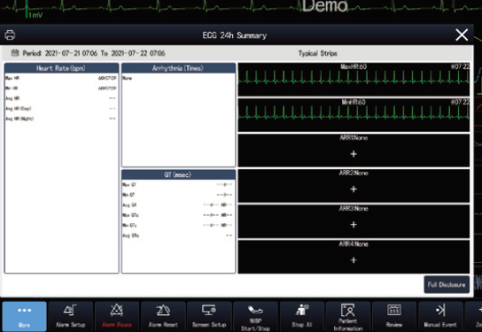 Resumen de ECG de 24 horas del monitor Serie K Pro