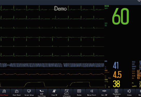 ECG de 6 derivaciones en el monitor Serie K Pro